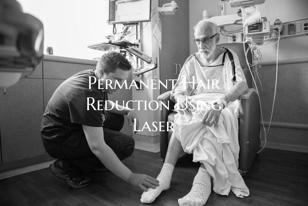 Permanent Hair Reduction Using Laser