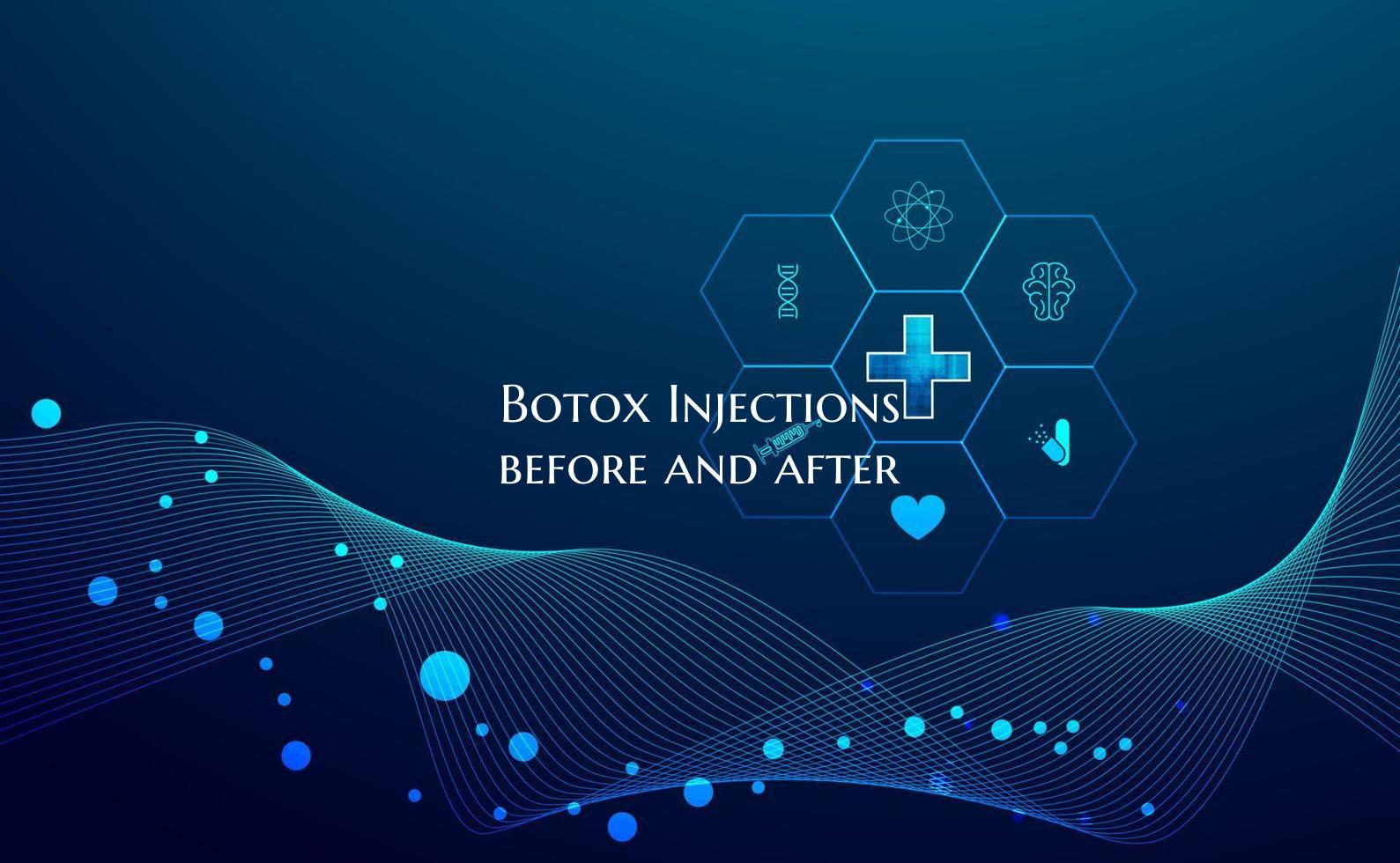 Botox Injections before and after