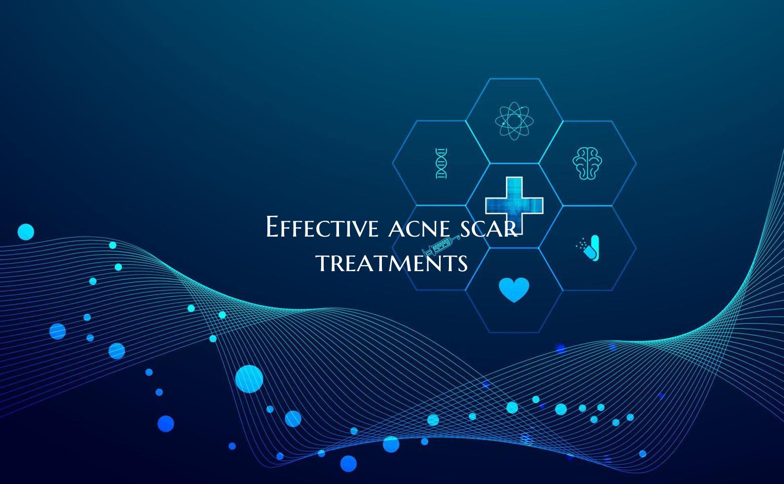 Effective acne scar treatments