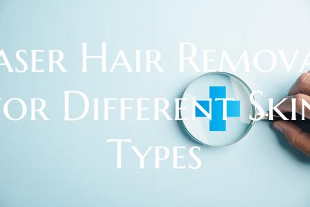 Laser Hair Removal for Different Skin Types