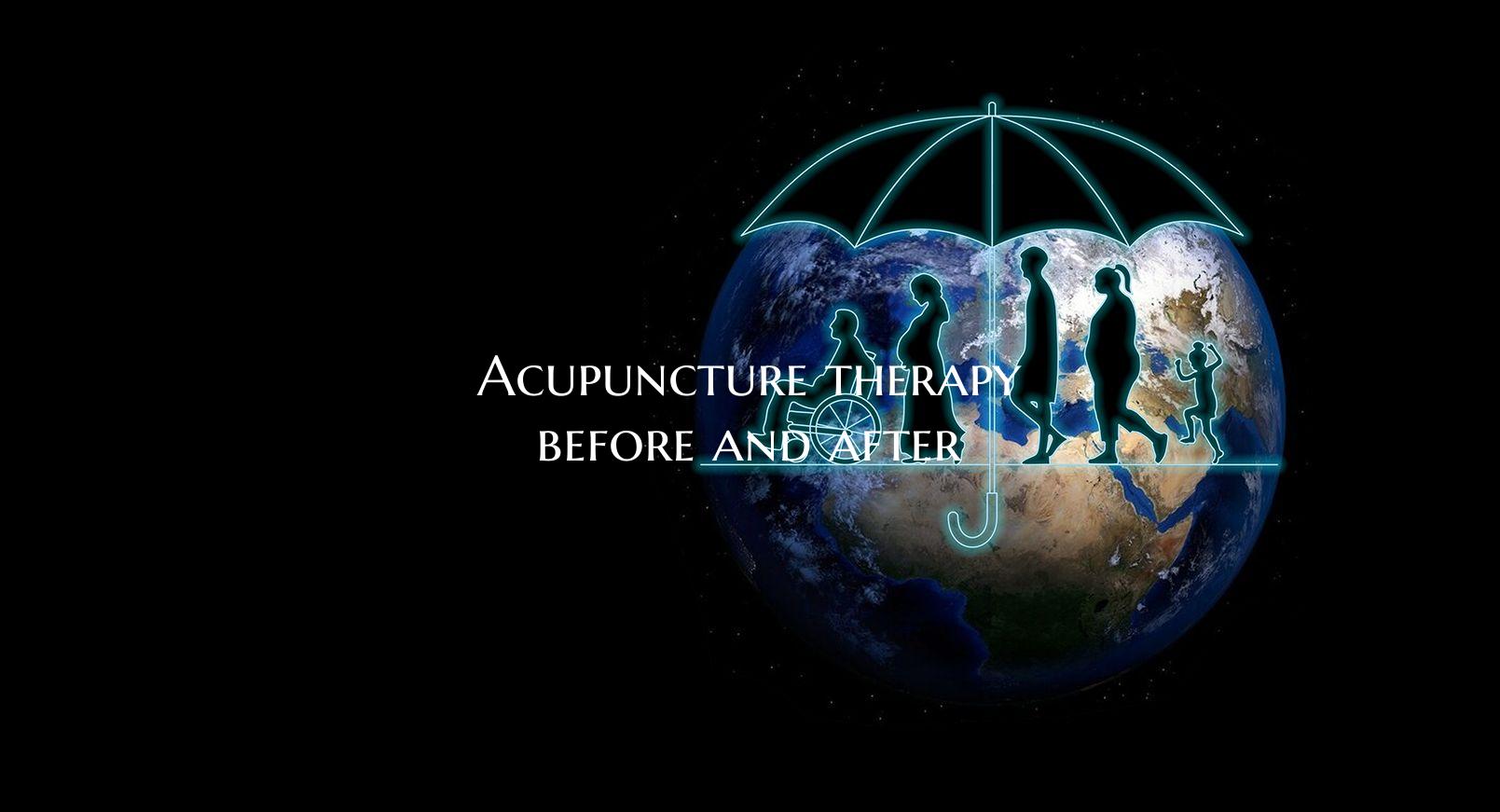 Acupuncture therapy before and after