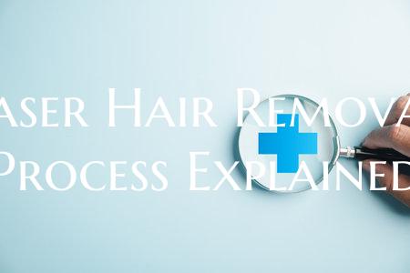 Laser Hair Removal Process Explained
